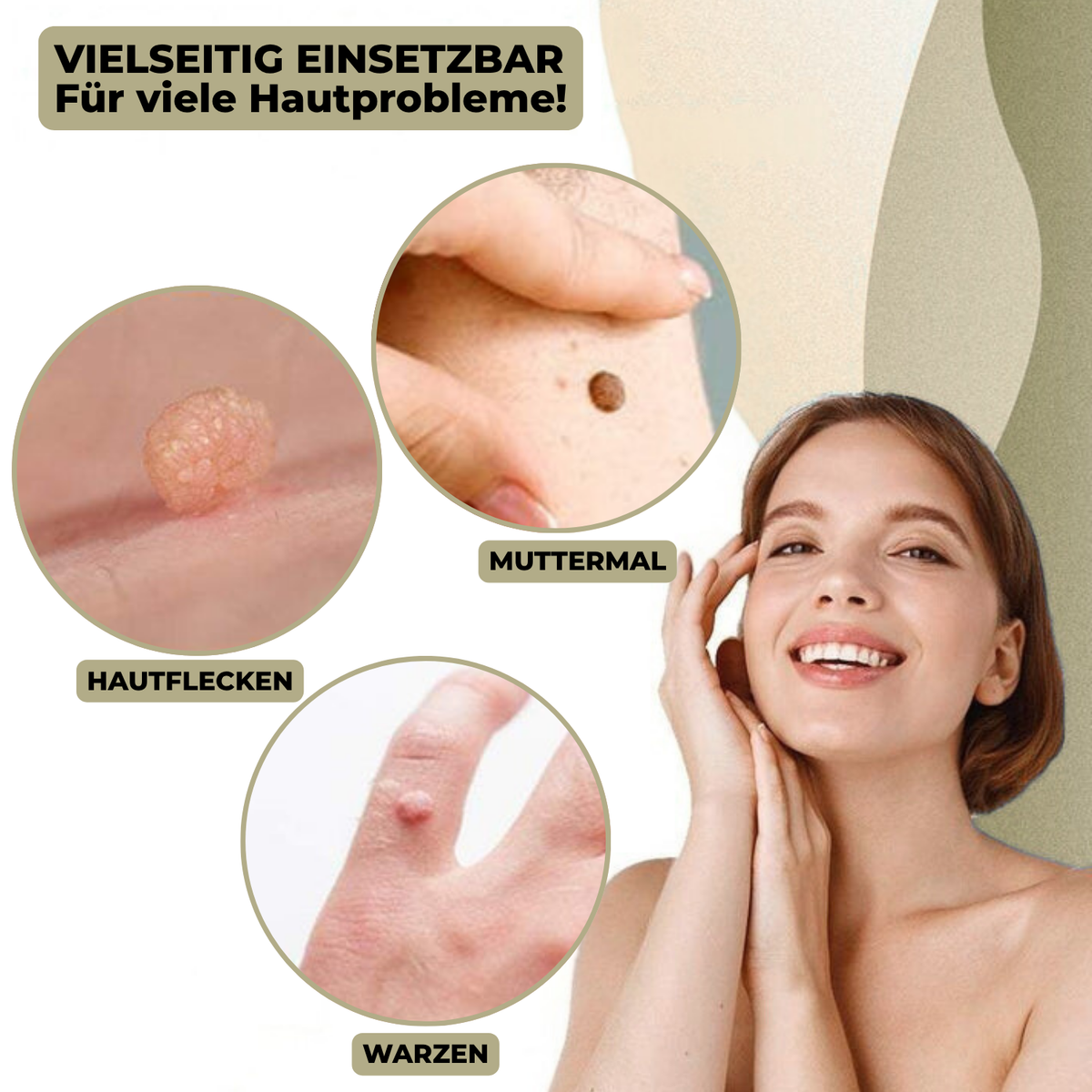Lindegade | DermaLinx Vortefjerner | Smertefri Fjernelse af Vorter & Modermærker | Til Hjemmet | Uden Kirurgi