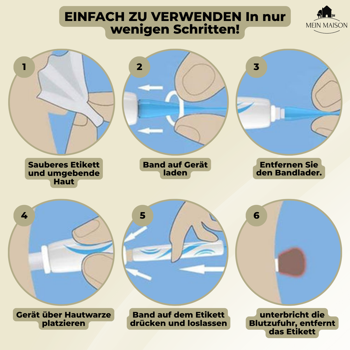 Lindegade | DermaLinx Vortefjerner | Smertefri Fjernelse af Vorter & Modermærker | Til Hjemmet | Uden Kirurgi