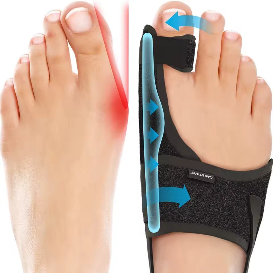 Lindegade | Natskinne Hallux Valgus - Ergonomisk og Justerbar Komfort