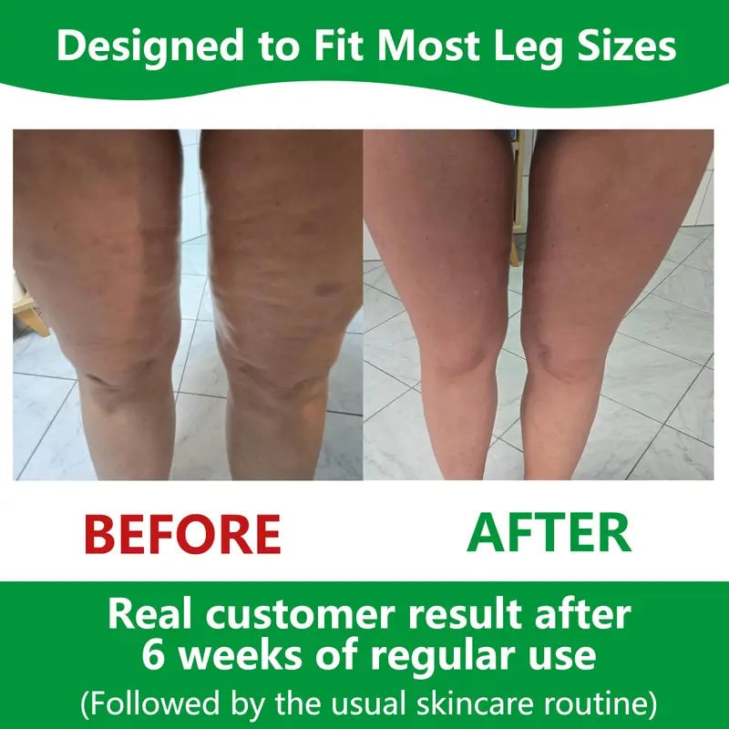 Lindegade | Sakerplus Cellulite Massage Roller