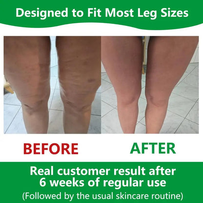 Lindegade | Sakerplus Cellulite Massage Roller