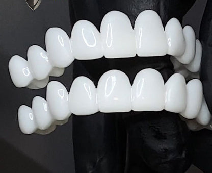 Lindegade | Snap-On Kosmetiske Facader | Øjeblikkelig Smile Dækning for Imperfektioner