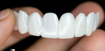 Lindegade | Snap-On Kosmetiske Facader | Øjeblikkelig Smile Dækning for Imperfektioner