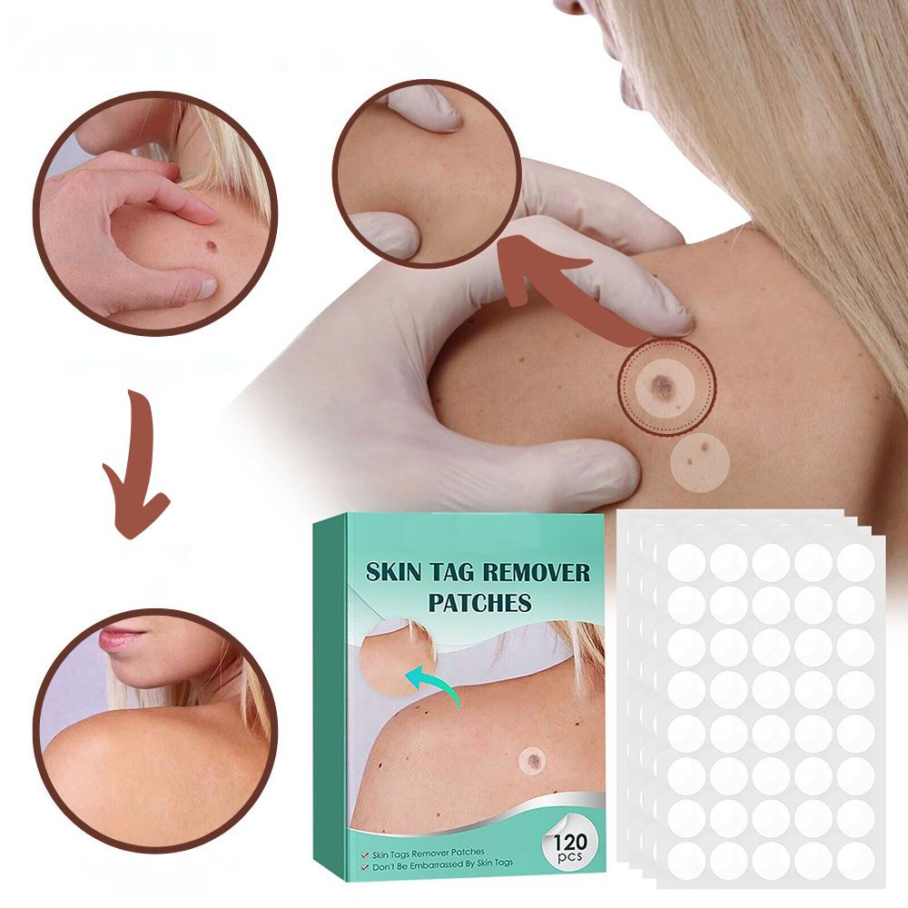 SkinClear - Patches til fjernelse af pletter og vorter Lindegade