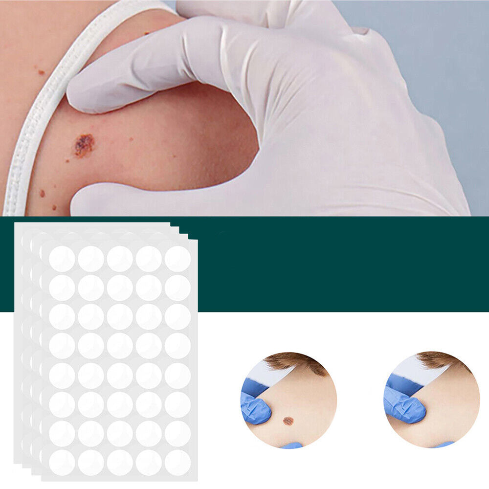 SkinClear - Patches til fjernelse af pletter og vorter Lindegade