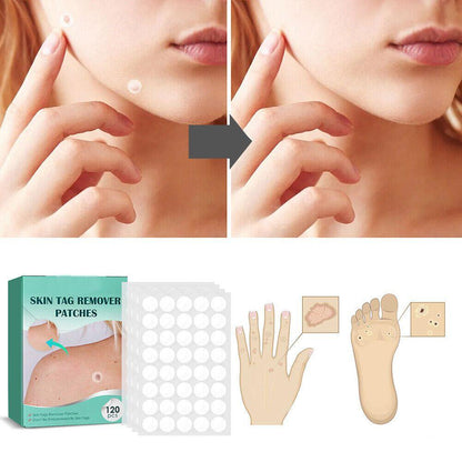 SkinClear - Patches til fjernelse af pletter og vorter Lindegade