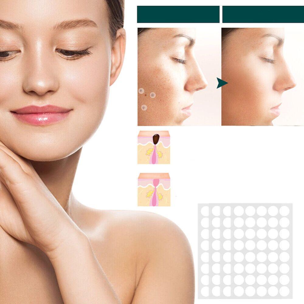 SkinClear - Patches til fjernelse af pletter og vorter Lindegade