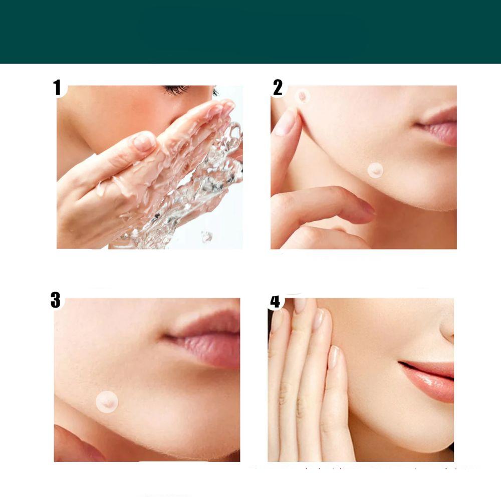 SkinClear - Patches til fjernelse af pletter og vorter Lindegade